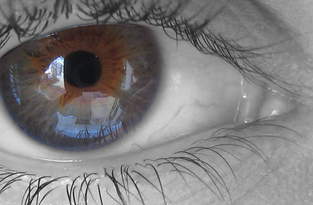 oftalmologo malaga degeneracion macular